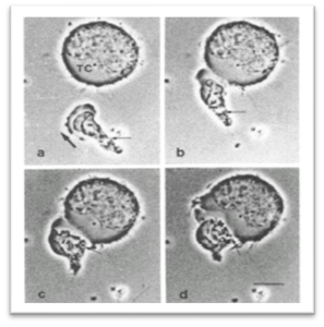 a cytotoxic T-Lymphocyte delivering a lethal hit to a cancer cell utilizing high-resolution cinemicrography