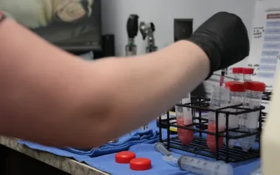 Does PRP Have Anti-Microbial Properties